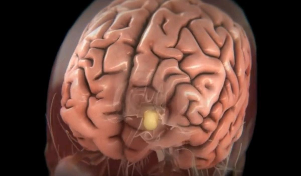 Ученые перевели мысли мозга в устную речь
